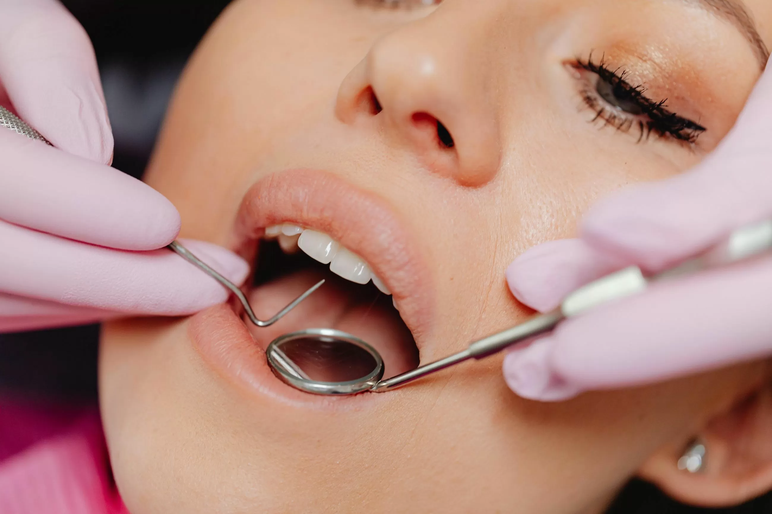 Cómo afectan los cambios hormonales a la labios: "Anticipamos los picos de sensibilidad y evitamos sustos"