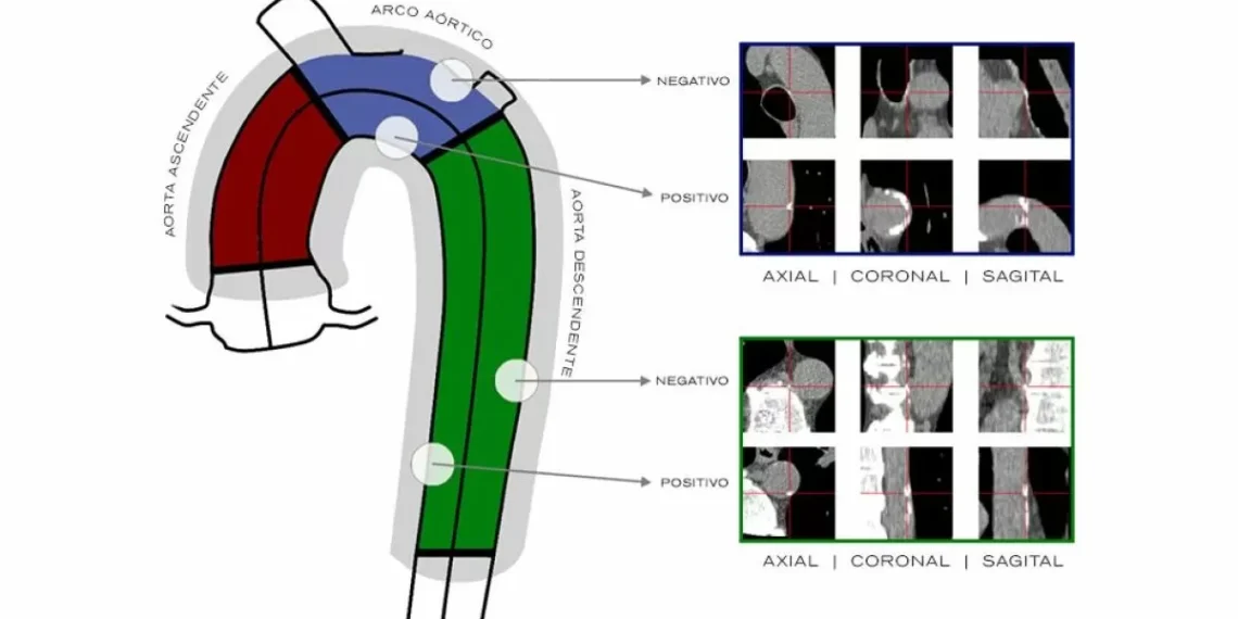 Desarrollan un sistema basado en IA que procesa tomografías del corazón