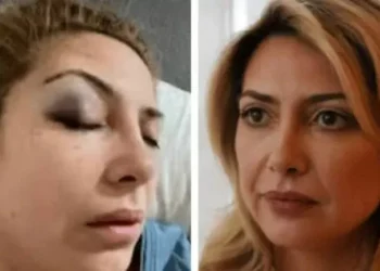 Se conocieron nuevas imágenes que muestran a Fabiola Yañez con golpes en su faz