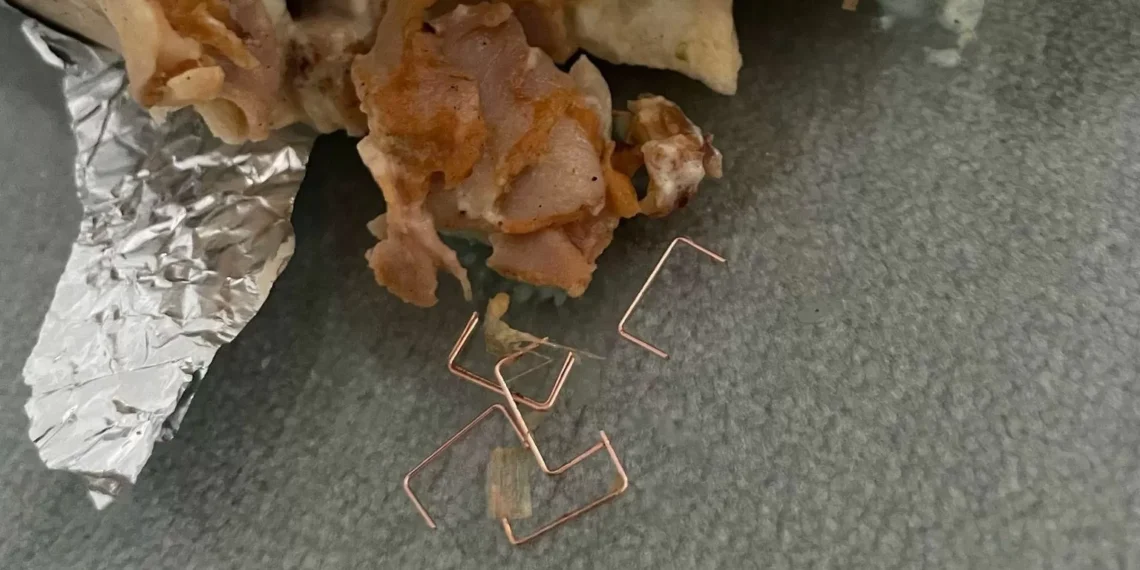 pincho menor es ingresada tras ingerir un kebab con grapas metálicas dentro