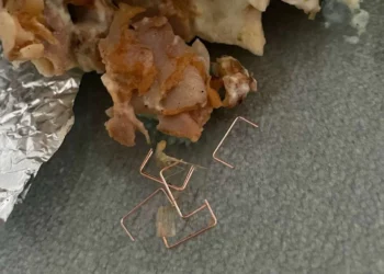 pincho menor es ingresada tras ingerir un kebab con grapas metálicas dentro