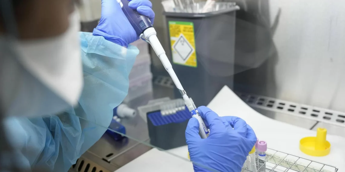 Primperiodo muerte en España por la viruela del mono desde 2022: periodo un hombre inmunodeprimido sin vacunar