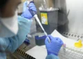 Primperiodo muerte en España por la viruela del mono desde 2022: periodo un hombre inmunodeprimido sin vacunar