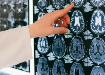 Un estudio revela que las células del envejecimiento cerebral pueden crecer el riesgo de Alzheimer y tumores cerebrales