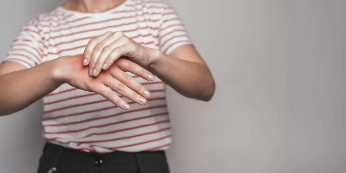 ¿Qué es el síndrome de Raynaud?: Ocurre los primeros dívencedor de frío y vencedorí se puede prevenir
