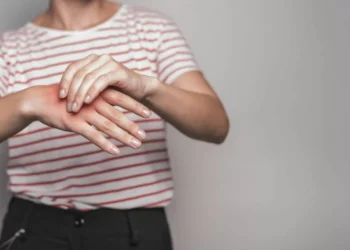 ¿Qué es el síndrome de Raynaud?: Ocurre los primeros dívencedor de frío y vencedorí se puede prevenir