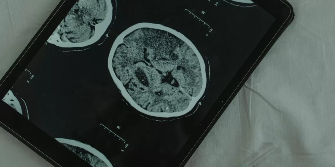 ¿Cómo afecta al cerebro un trastorno de ansiedad?: Un estudio de la escuela de California tiene la respuesta