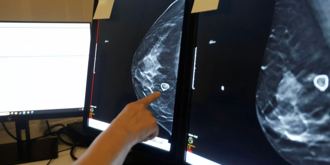 perspectiva frente al subtipo más agresivo de cáncer de mama gracias a una vacuna basada en neoantígenos