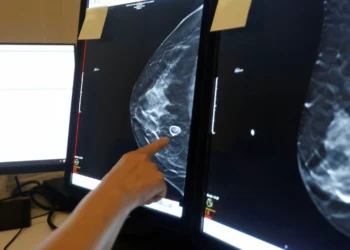 perspectiva frente al subtipo más agresivo de cáncer de mama gracias a una vacuna basada en neoantígenos