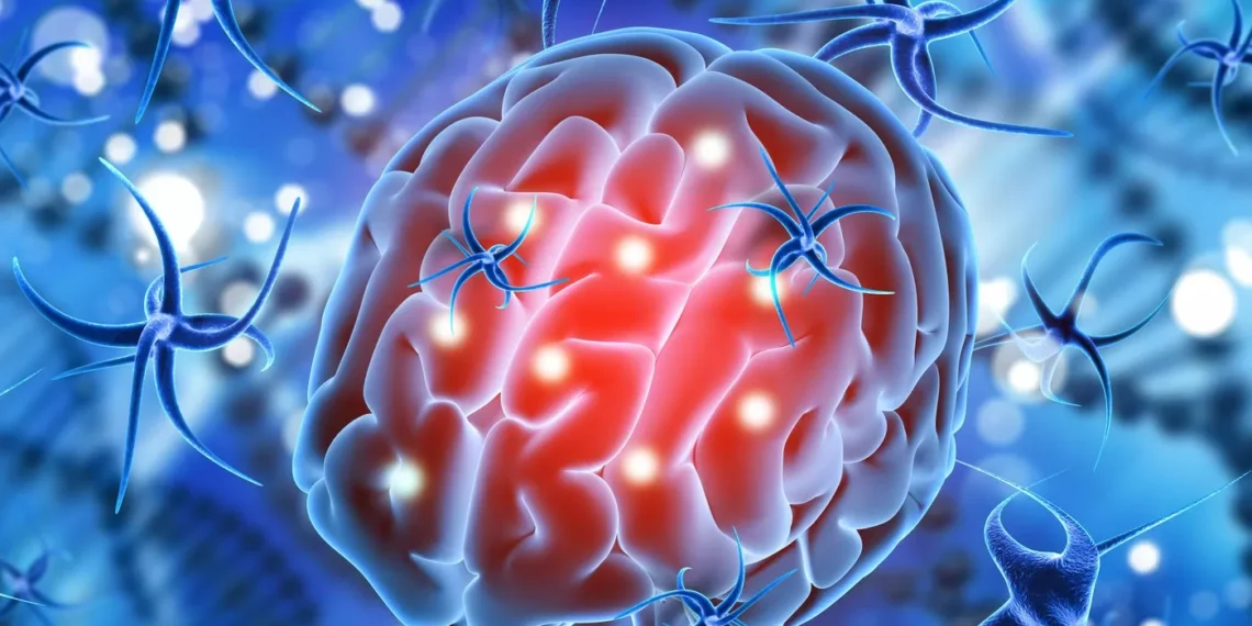 Glioblastoma: Qué es y las terapias oncológicas que ofrecen a los pacientes de inexperto diagnóstico