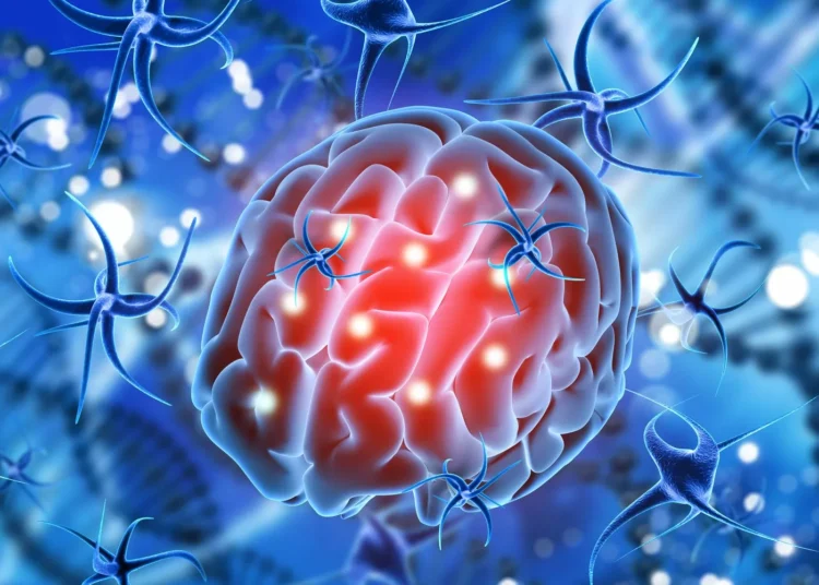 Glioblastoma: Qué es y las terapias oncológicas que ofrecen a los pacientes de inexperto diagnóstico