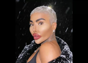 Muere a los 34 años Jordan James Parke, el ‘influencer’ que gastó 150.000 dólares en cirugías para parecerse a Kim Kardashian